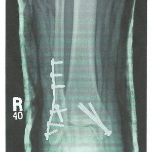 Meet your Posher, Toubee